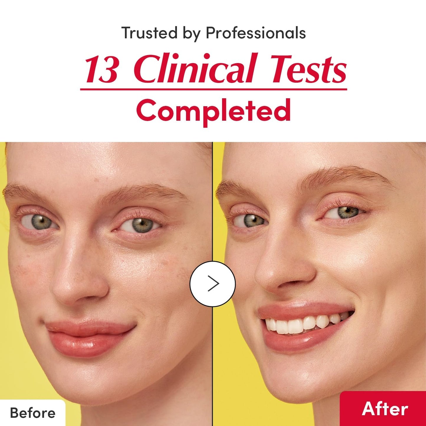 Minimises the appearance of visible signs of ageing