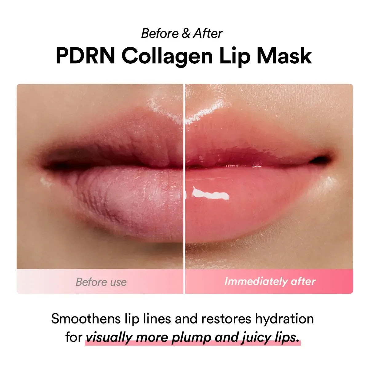 Abib PDRN COLLAGEN LIP MASK GLAZED JELLY 11G - My Seoul My Skin