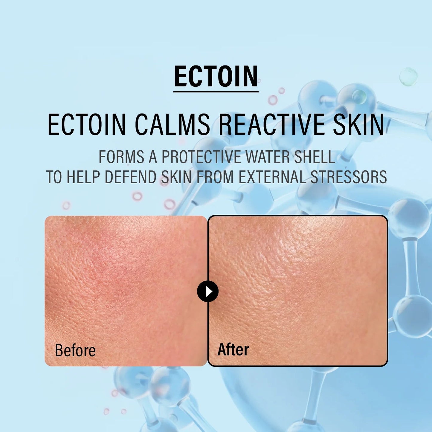 epii Double Up Cream Ectoin & Panthenol – Korean Barrier Cream for Dry & Sensitive Skin epii