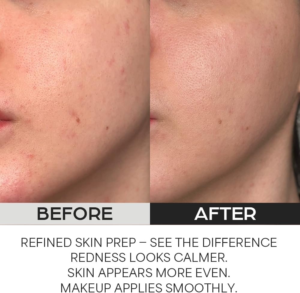 HOUSE OF HUR Clearing Skin Prep Essence Pad 70 Pads – Korean Exfoliating Toner Pads for Pores & Texture HOUSE OF HUR