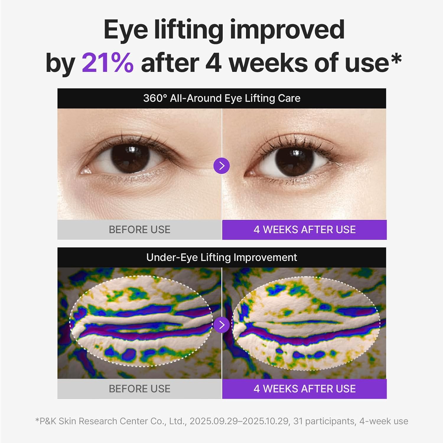 Centellian24 360º Shot PDRN Lifting Eye Cream – Korean Firming Eye Cream for Fine Lines & Elasticity Centellian24