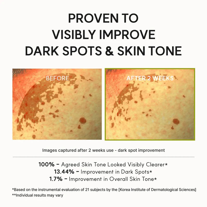 ARENCIA Vitamin C Booster Shot 30ml – Korean Brightening Serum for Dark Spots & Glow Arencia