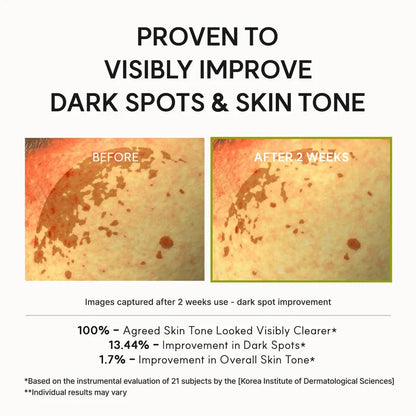 ARENCIA Vitamin C Booster Shot 30ml – Korean Brightening Serum for Dark Spots & Glow Arencia